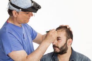 Is the cost of hair transplantation in Turkey high? 