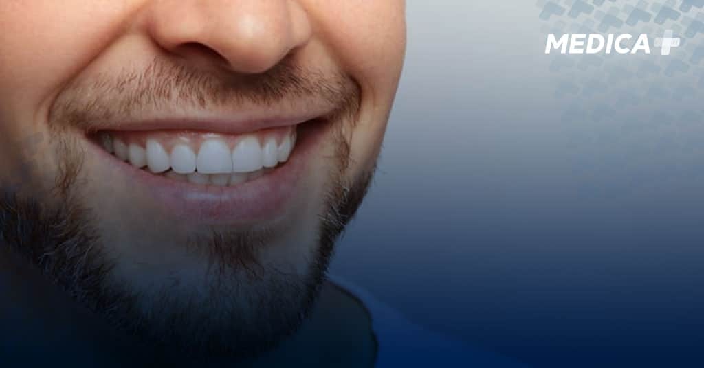 How much does a Hollywood smile cost in Turkey؟