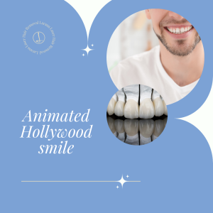 Animated Hollywood smile