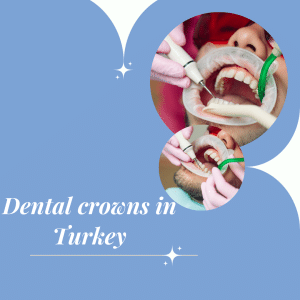 Dental crowns in Turkey