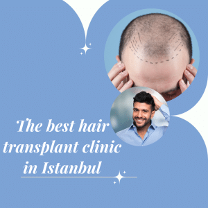 The best hair transplant clinic in Istanbul