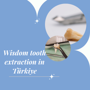 Wisdom tooth extraction in Türkiye