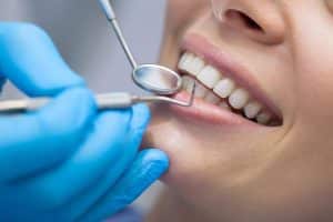 Dental treatment techniques in Istanbul